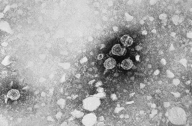 BREAKING: Outbreak Of Hepatitis In Ukraine – Vinnytsia Locked Down